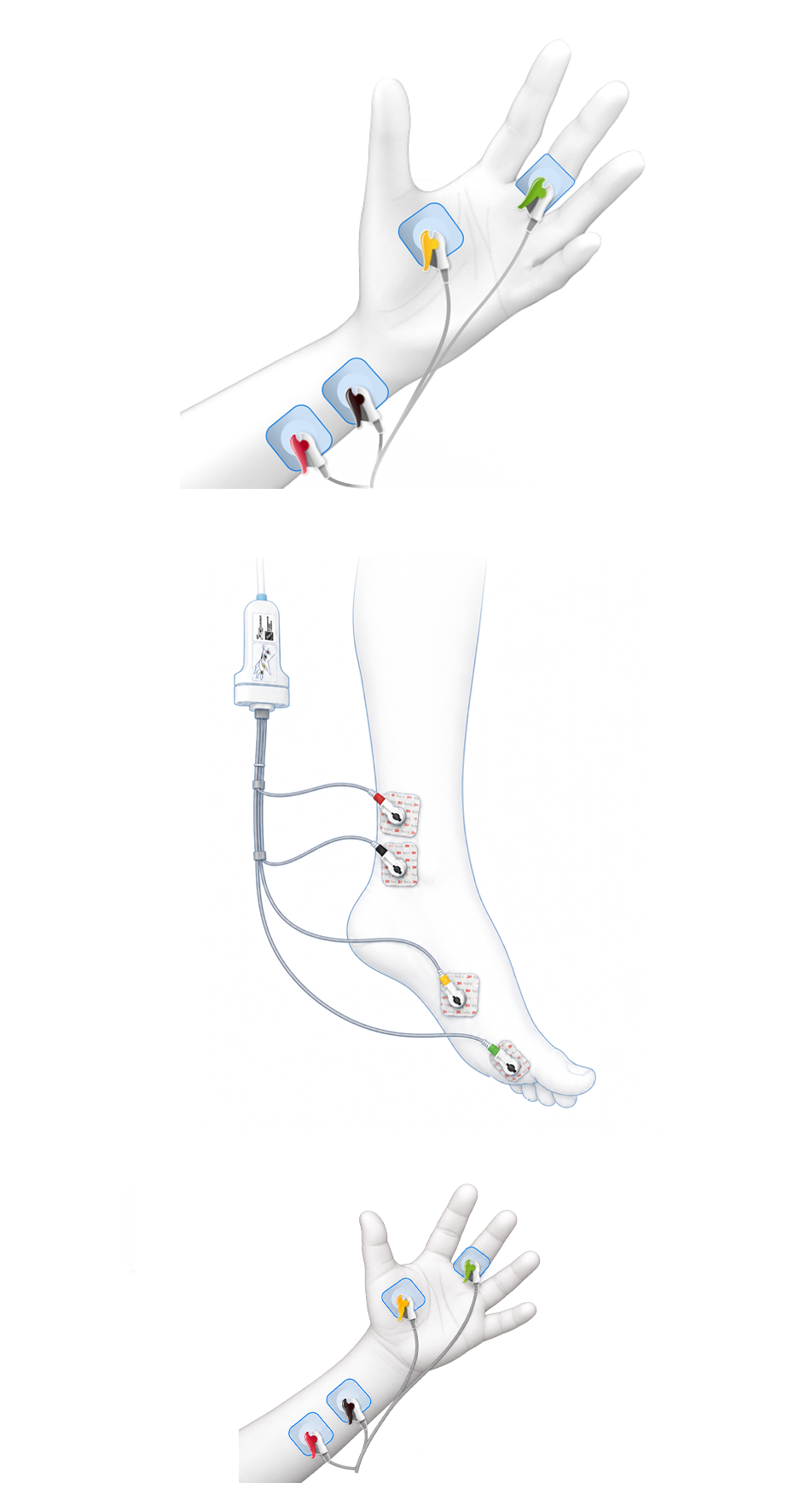 Reusable EMG sensor